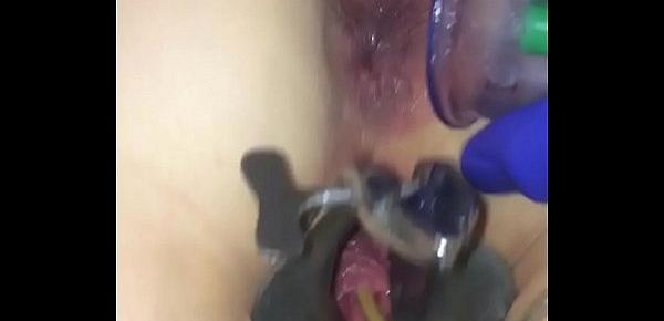  Anal injections female